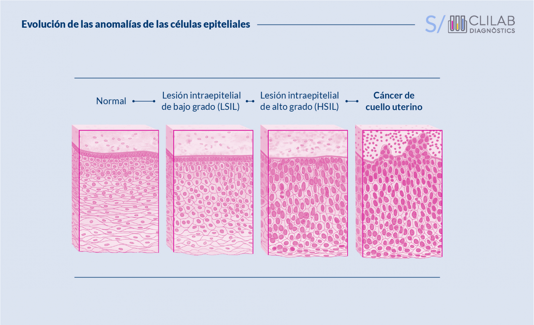 Evolución de las anomalías de las células epiteliales