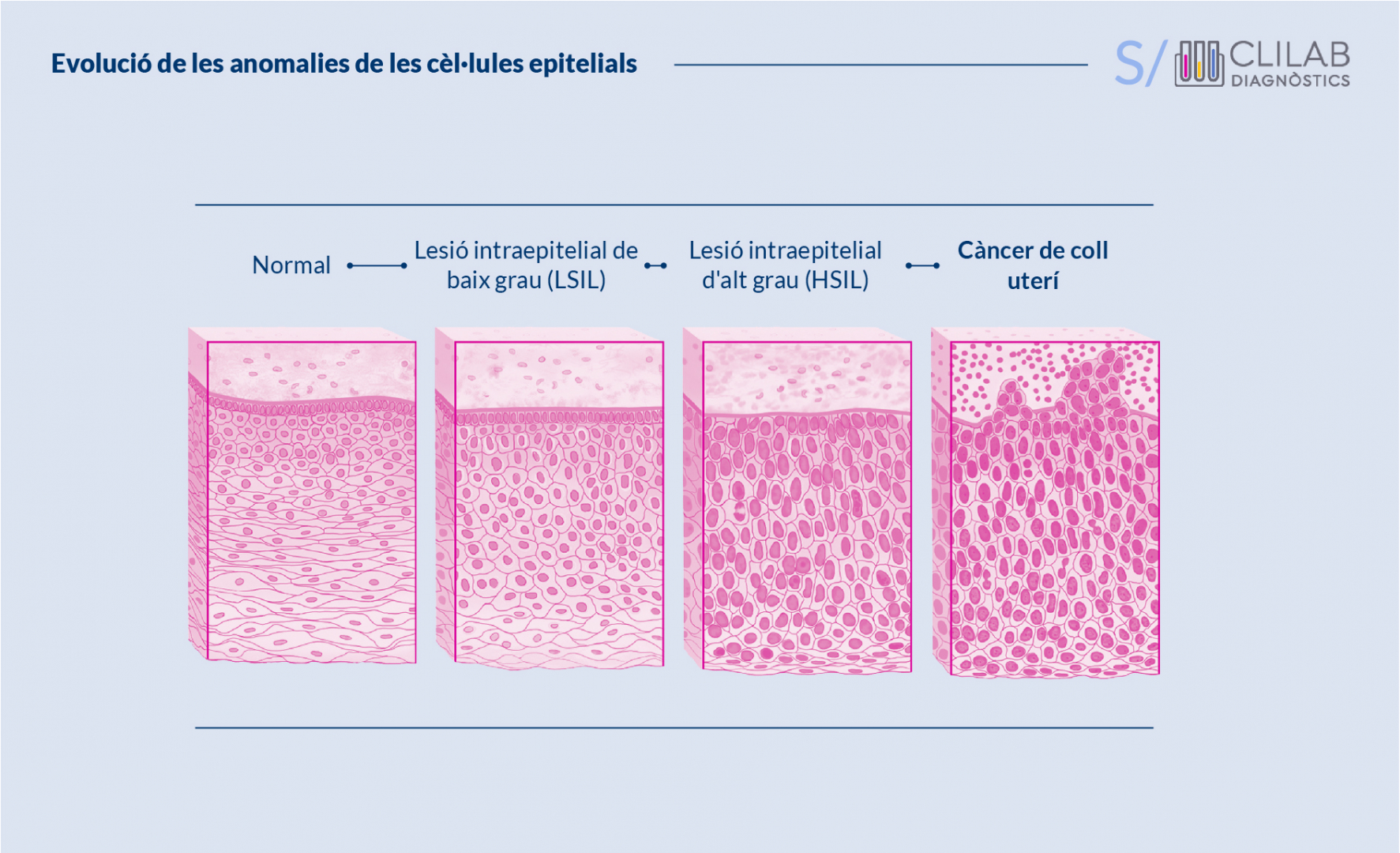 Evolució de les anomalies de les cèl·lules epitelials