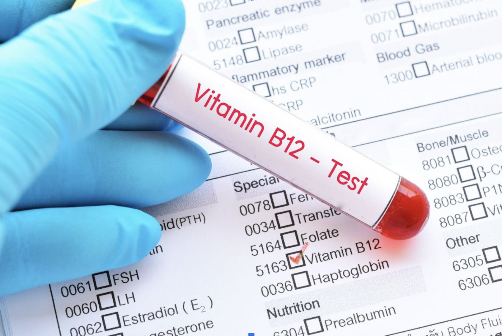 Diagnóstico del déficit de vitamina B12: lo que debes saber