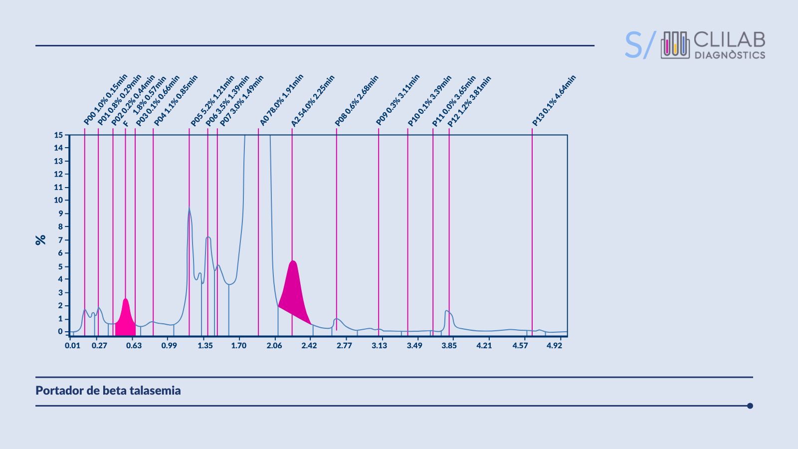 HPLC_talasemia