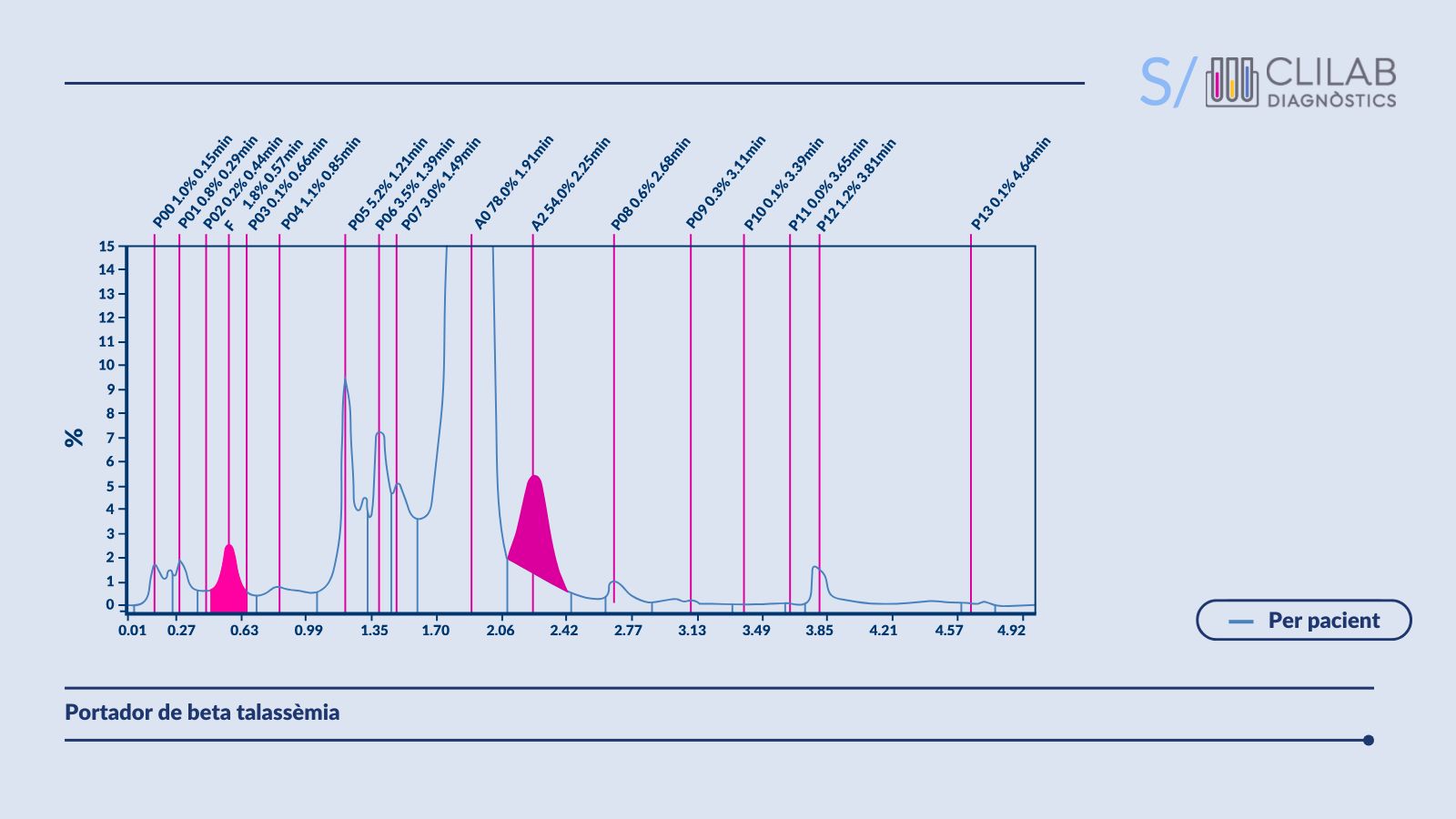 HPLC d'un pacient amb talassèmia.