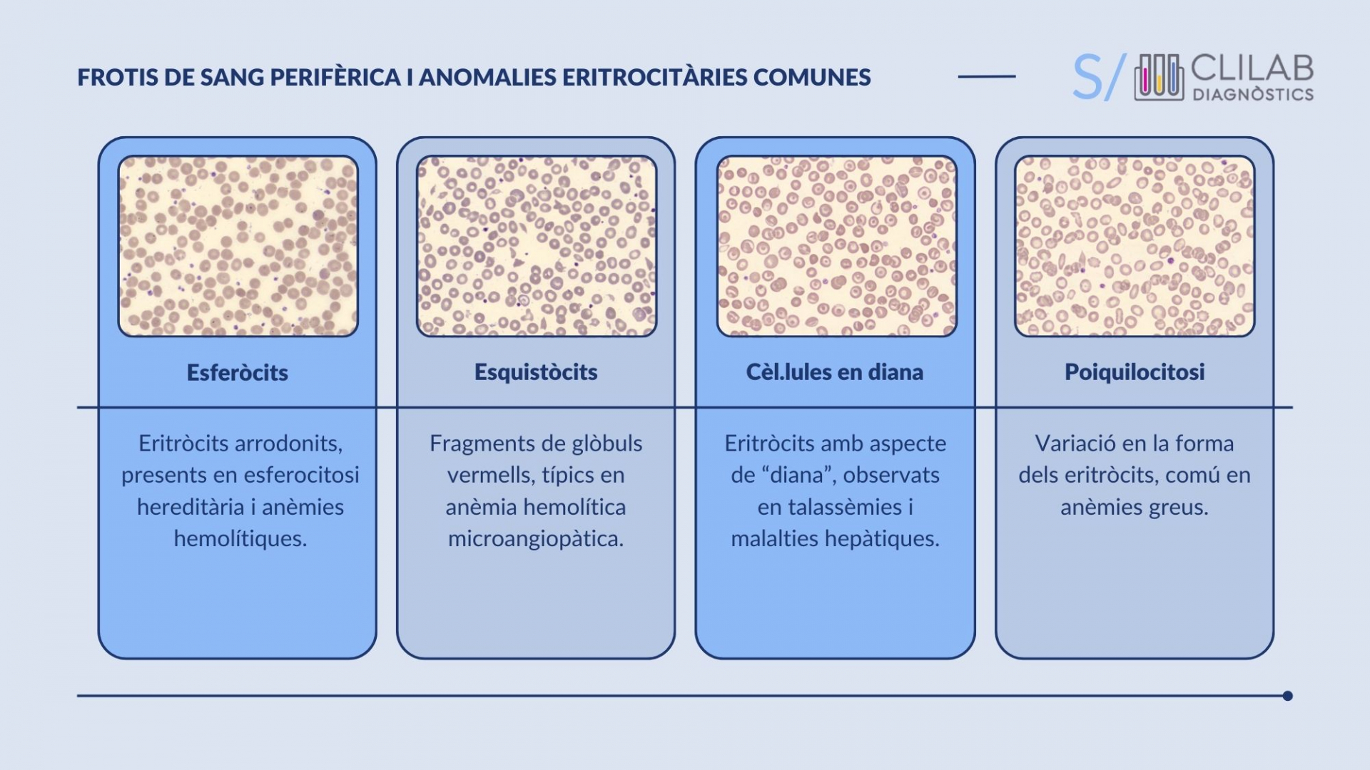 Frotis de sang perifèrica