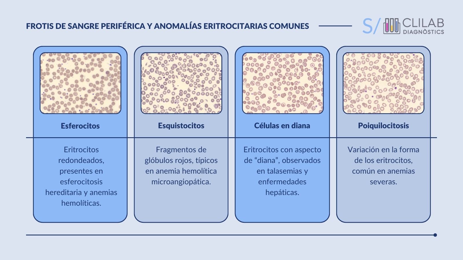 Frotis de sangre periférica