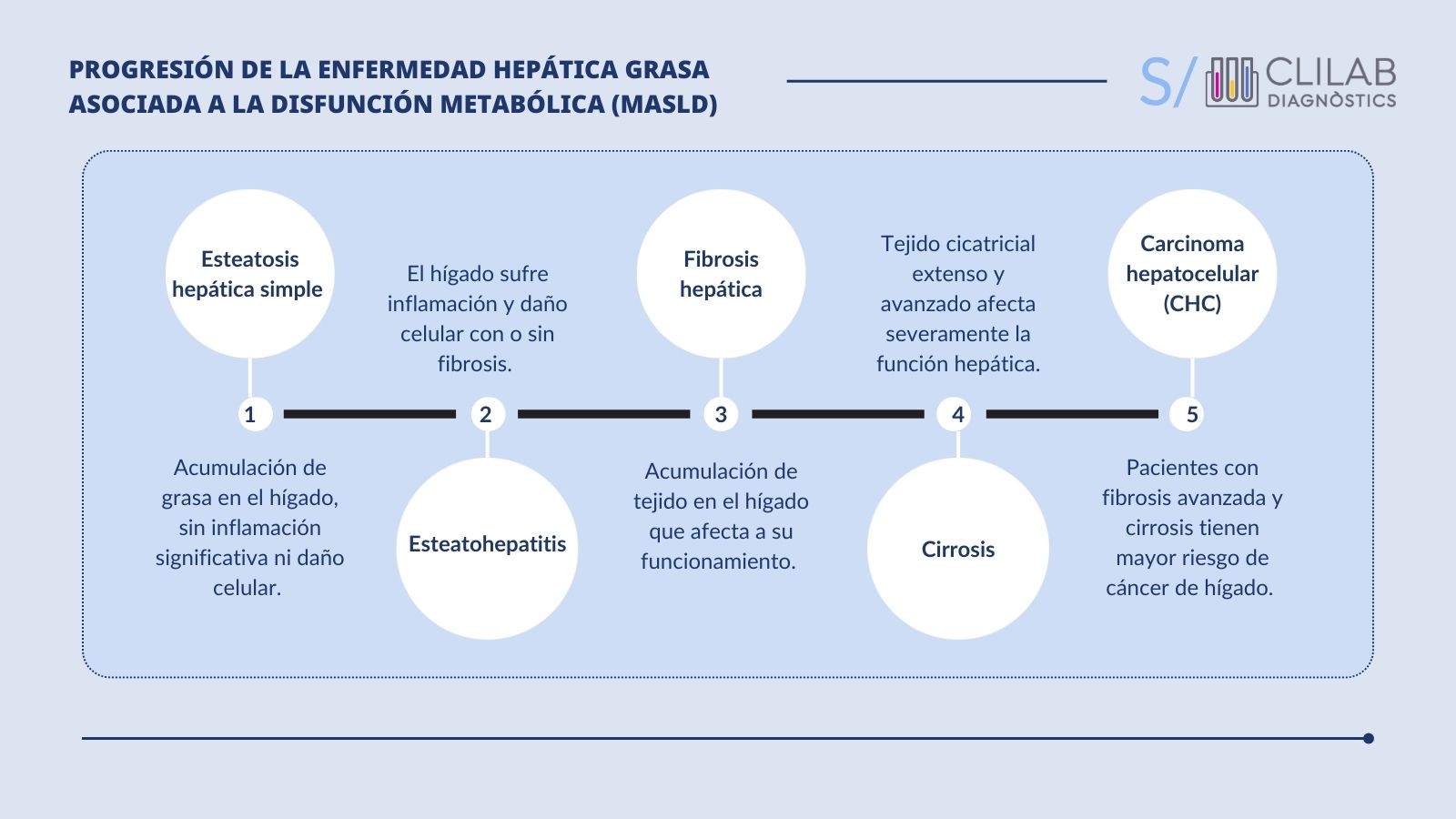 Progresión de LA Enfermedad hepática grasa asociada a la disfunción metabólica (MASLD)