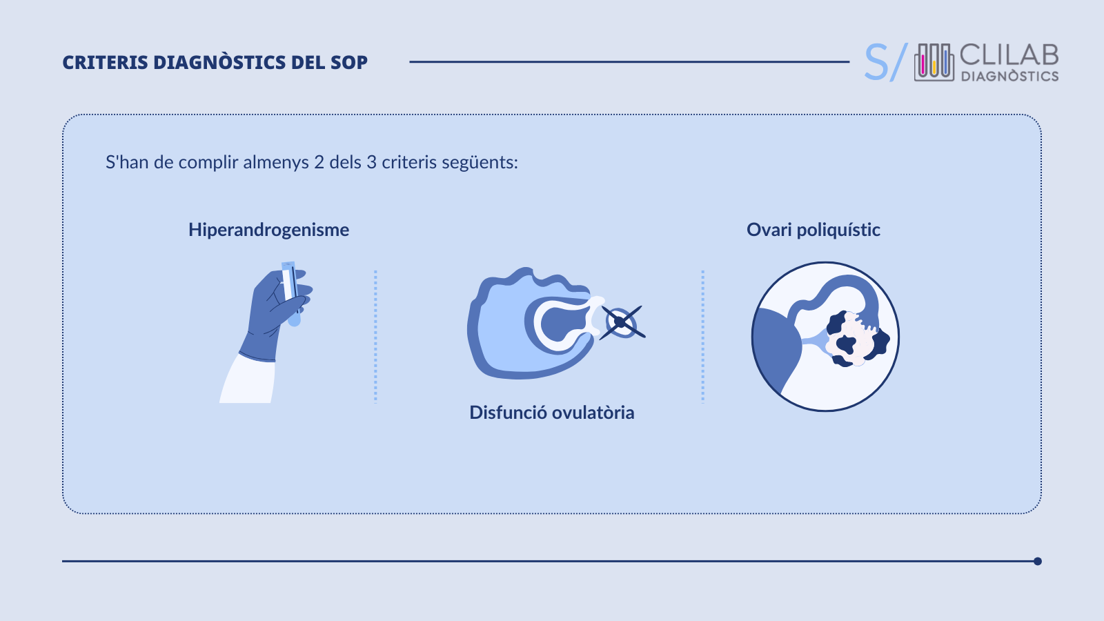 Criteris diagnòstics del SOP