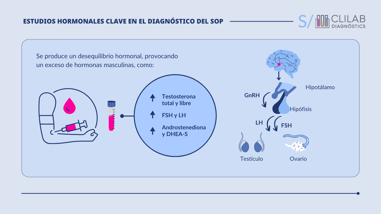 Estudios hormonales clave en el diagnóstico del SOP