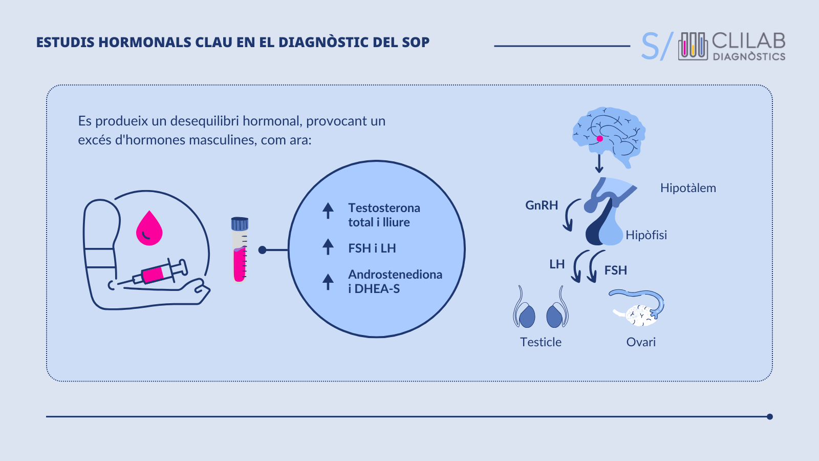 Estudis hormonals clau en el diagnòstic del SOP