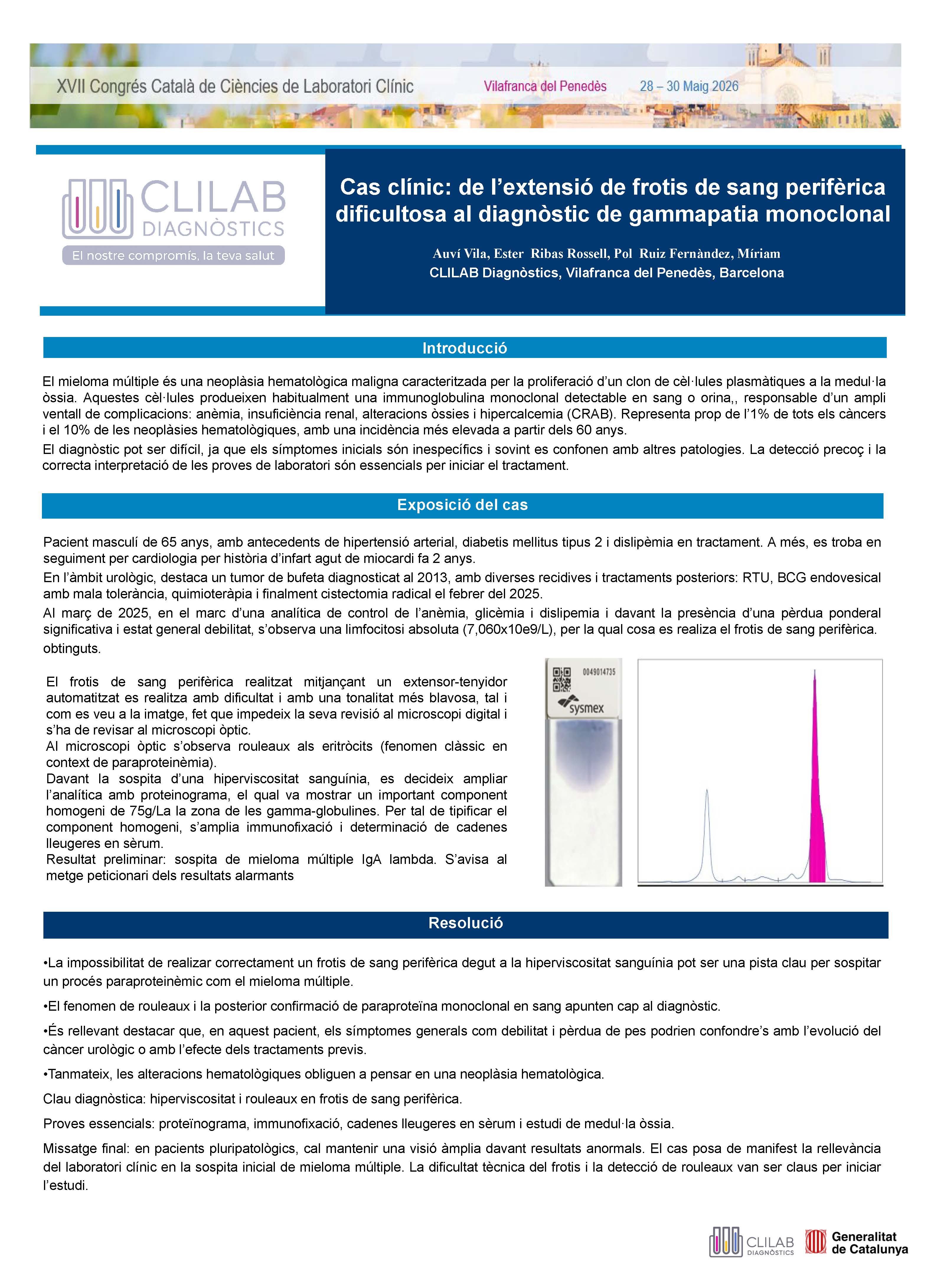 Cas clínic: de l’extensió dificultosa de frotis de sang perifèrica al diagnòstic de gammapatia monoclonal